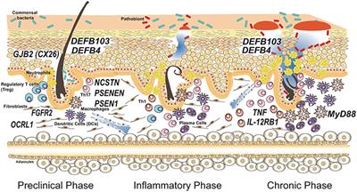 An Integrated Approach to Unravel Hidradenitis Suppurativa Etiopathogenesis